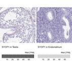 Anti-SYCP1 Antibody