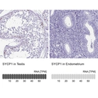 Anti-SYCP1 Antibody