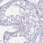 Immunohistochemical staining of human testis shows high expression.