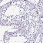 Immunohistochemical staining of human testis shows high expression.
