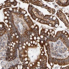 Anti-RGP1 Antibody