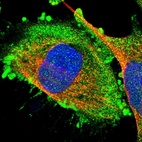 Immunofluorescent staining of human cell line U-251 MG shows localization to plasma membrane & cytosol.