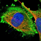 Immunofluorescent staining of human cell line U-251 MG shows localization to plasma membrane & cytosol.