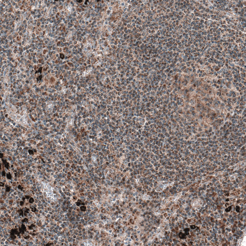 Anti-ZCCHC7 Antibody
