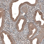 Immunohistochemical staining of human endometrium shows strong positivity in nucleoli in glandular cells.