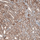 Immunohistochemical staining of human kidney shows strong positivity in nucleoli in cells in tubules.
