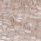 Immunohistochemical staining of human skeletal muscle shows weak cytoplasmic positivity in myocytes.