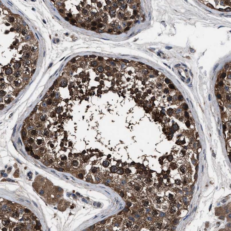 Anti-RNF216 Antibody