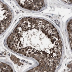 Anti-RNF216 Antibody