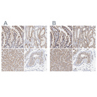 Anti-SGPL1 Antibody