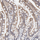 Anti-SGPL1 Antibody