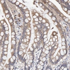 Immunohistochemical staining of human colon shows moderate cytoplasmic positivity in glandular cells.