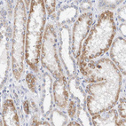 Anti-SGPL1 Antibody