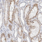 Immunohistochemical staining of human kidney shows moderate granular cytoplasmic positivity in cells in tubules.