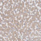 Immunohistochemical staining of human liver shows weak to moderate granular cytoplasmic positivity in hepatocytes.
