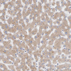 Anti-SGPL1 Antibody