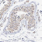 Anti-SGPL1 Antibody