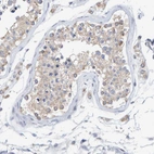 Immunohistochemical staining of human testis shows weak to moderate granular cytoplasmic positivity in cells in seminiferous ducts.