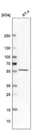 Western blot analysis in human cell line RT-4.
