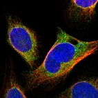 Immunofluorescent staining of human cell line U-2 OS shows localization to endoplasmic reticulum.
