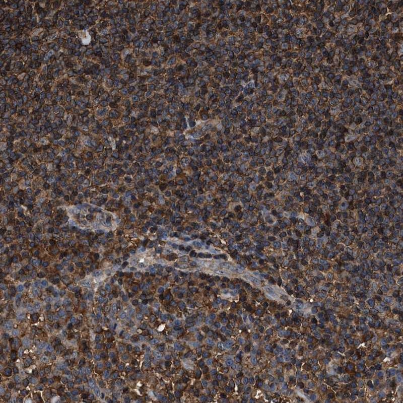 Anti-KBTBD2 Antibody