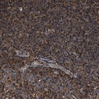 Anti-KBTBD2 Antibody