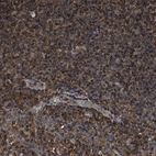 Anti-KBTBD2 Antibody