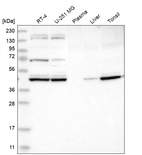 Western blot analysis in human cell line RT-4, human cell line U-251 MG, human plasma, human liver tissue and human tonsil tissue.