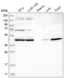 Western blot analysis in human cell line RT-4, human cell line U-251 MG, human plasma, human liver tissue and human tonsil tissue.