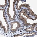Anti-TMEM53 Antibody