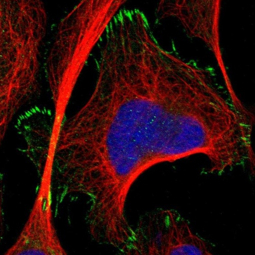Anti-TMEM53 Antibody