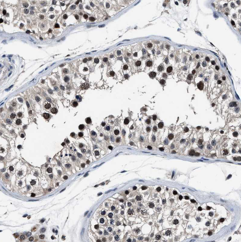 Anti-USP16 Antibody