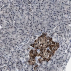 Immunohistochemical staining of human pancreas shows strong cytoplasmic positivity in islets of Langerhans.