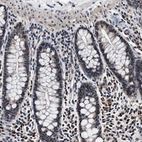 Immunohistochemical staining of human gastrointestinal shows strong nuclear positivity in glandular cells.