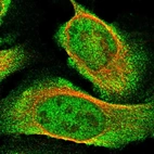 Immunofluorescent staining of human cell line U-2 OS shows localization to nucleoplasm & cytosol.