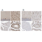 Immunohistochemical staining of human cerebellum, cerebral cortex, skeletal muscle and testis using Anti-ATXN2 antibody HPA021146 (A) shows similar protein distribution across tissues to independent antibody HPA018295 (B).