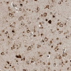 Immunohistochemical staining of human cerebral cortex shows moderate to strong cytoplasmic positivity in neurons.
