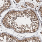 Immunohistochemical staining of human testis shows moderate cytoplasmic positivity in cells in seminiferous ducts.