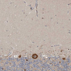 Immunohistochemical staining of human cerebellum shows strong cytoplasmic positivity in Purkinje cells.