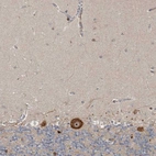 Immunohistochemical staining of human cerebellum shows strong cytoplasmic positivity in Purkinje cells.