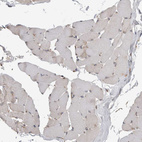 Immunohistochemical staining of human skeletal muscle shows very weak positivity in myocytes as expected.