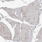 Immunohistochemical staining of human skeletal muscle shows very weak positivity in myocytes as expected.