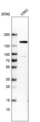 Western blot analysis in human cell line K562.