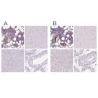 Anti-MPO Antibody