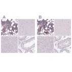 Immunohistochemical staining of human bone marrow, cerebral cortex, liver and testis using Anti-MPO antibody HPA021147 (A) shows similar protein distribution across tissues to independent antibody HPA061464 (B).