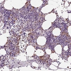Immunohistochemical staining of human bone marrow shows moderate cytoplasmic positivity in hematopoietic cells.