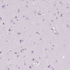 Immunohistochemical staining of human cerebral cortex shows no positivity in neurons as expected.
