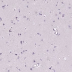 Immunohistochemical staining of human cerebral cortex shows no positivity in neurons as expected.