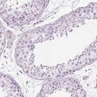 Immunohistochemical staining of human testis shows no positivity in cells in seminiferous ducts as expected.