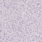 Immunohistochemical staining of human liver shows no positivity in hepatocytes as expected.